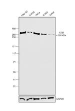 ATM Antibody in Western Blot (WB)