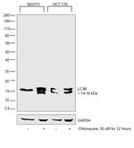 LC3A/LC3B Antibody in Western Blot (WB)