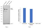 53BP1 Antibody in Western Blot (WB)