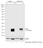 LC3B Antibody in Western Blot (WB)