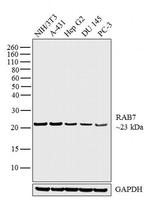 RAB7 Antibody in Western Blot (WB)