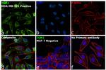 TGM2 Antibody