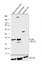 OLIG2 Antibody in Western Blot (WB)