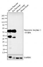 Pancreatic Amylase Antibody