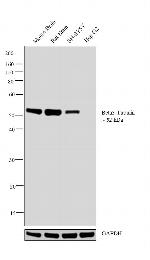 beta-3 Tubulin Antibody