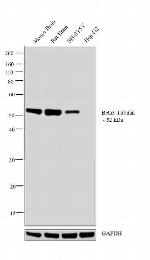 beta-3 Tubulin Antibody in Western Blot (WB)