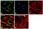 VCAM-1 Antibody in Immunocytochemistry (ICC/IF)