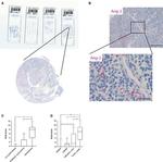 Angiopoietin 2 Antibody in Immunohistochemistry (IHC)