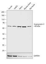 Angiopoietin 2 Antibody in Western Blot (WB)