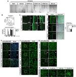 NFkB p52 Antibody in Immunocytochemistry (ICC/IF)