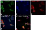 Lyn Antibody in Immunocytochemistry (ICC/IF)