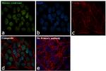 Blooms Syndrome Antibody in Immunocytochemistry (ICC/IF)