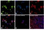 BCL6 Antibody