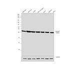 RhoGDI Antibody in Western Blot (WB)