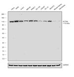 alpha Actinin 4 Antibody in Western Blot (WB)