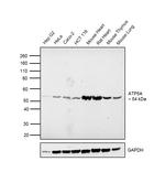 ATP5A1 Antibody in Western Blot (WB)