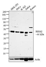 RRM2 Antibody in Western Blot (WB)