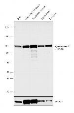 alpha Actinin 2 Antibody in Western Blot (WB)