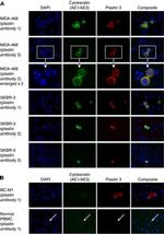 PLS3 Antibody in Immunocytochemistry (ICC/IF)