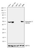 Cytokeratin 17 Antibody in Western Blot (WB)