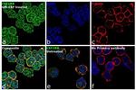 CSF2RB Antibody