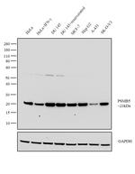 PSMB5 Antibody