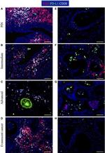 PD-L1 Antibody in Immunohistochemistry (IHC)