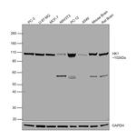 HK1 Antibody in Western Blot (WB)