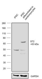 ST2 Antibody in Western Blot (WB)