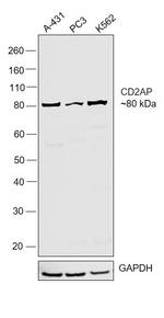 CD2AP Antibody in Western Blot (WB)