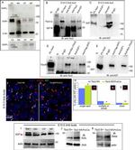 SPOP Antibody in Western Blot (WB)