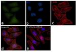 PGK1 Antibody in Immunocytochemistry (ICC/IF)