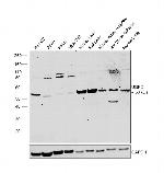 UGP2 Antibody in Western Blot (WB)