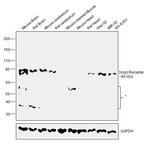 Nogo Receptor Antibody in Western Blot (WB)