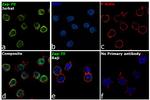 Zap-70 Antibody