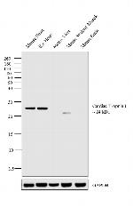 Cardiac Troponin I Antibody in Western Blot (WB)