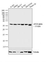 eIF2b alpha Antibody in Western Blot (WB)