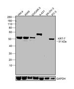 Cytokeratin 7 Antibody