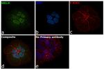 SALL4 Antibody in Immunocytochemistry (ICC/IF)