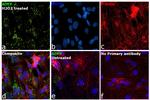 ADFP Antibody