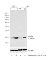 TIGAR Antibody