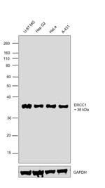 ERCC1 Antibody in Western Blot (WB)