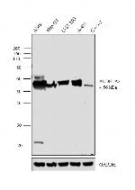 ALDH1A3 Antibody