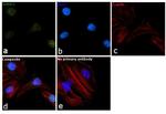 SMAD2 Antibody in Immunocytochemistry (ICC/IF)