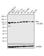 HK2 Antibody in Western Blot (WB)