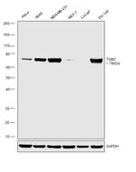 TGM2 Antibody in Western Blot (WB)