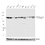 ATP Citrate Lyase Antibody in Western Blot (WB)