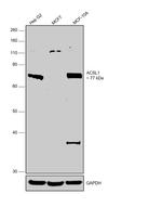 ACSL1 Antibody in Western Blot (WB)