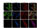 ApoA1 Antibody