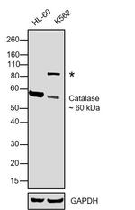 Catalase Antibody in Western Blot (WB)